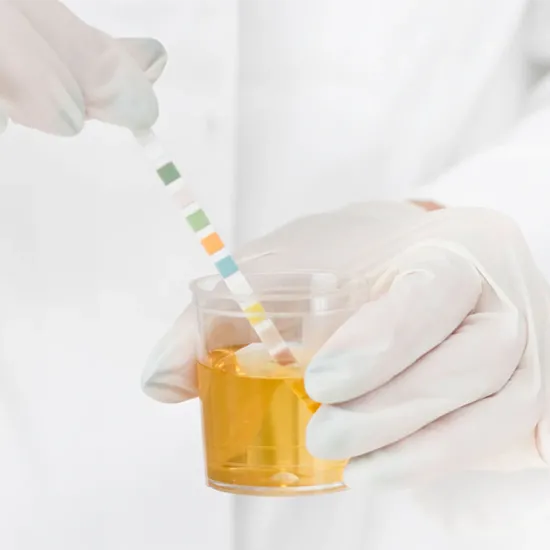 urine-pH test